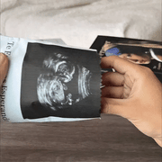 BabyLoop™ - El primer recuerdo de tu bebé